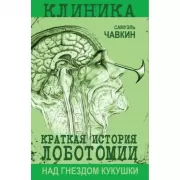 Над гнездом кукушки. Краткая история лоботомии
